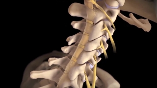 医学宣传动画-脊椎脊柱手术